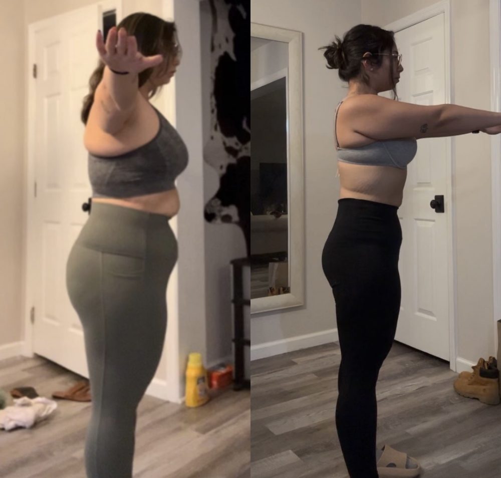 Client before and after: side view of her progress